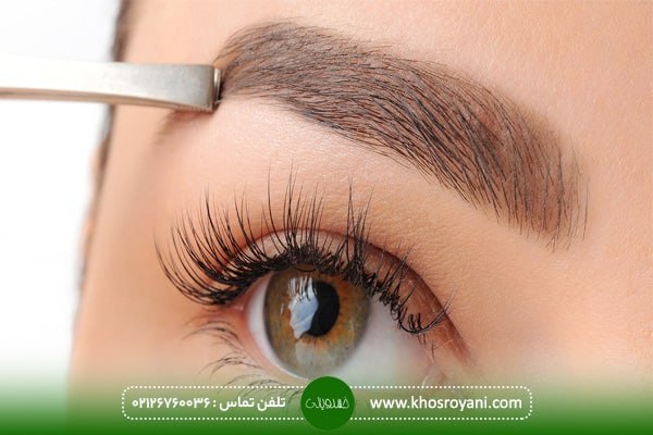 کاشت ابرو